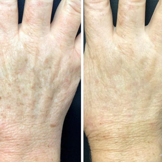 Beauty Body Factorie - Tranexamic + Vitamine C Lotion