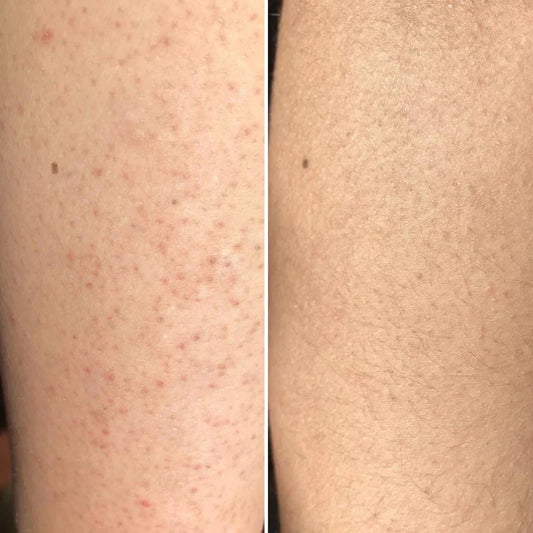 Beauty Body Factorie - AHA+BHA Exfoliating Bodylotion